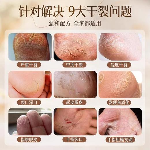 专属 马油膏脚后跟干裂霜防裂补水护手霜林足脱皮皴裂 50g/瓶 商品图1