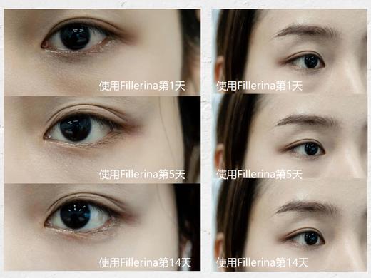 【10.27王炸割肉价】Fillerina菲勒莹娜丰盈精华套盒  1段#40%浓度初级老化/2段#50%浓度中级老化/5段#12渗玻尿酸深度老化 商品图4