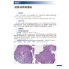 临床病理学疑难案例精析 临床病理住院医师规范化培训实践系列教材 主编应建明 冯晓莉 宋艳 9787117362573人民卫生出版社 商品缩略图3