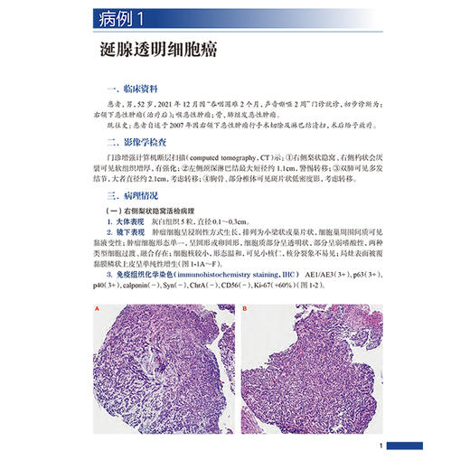 临床病理学疑难案例精析 临床病理住院医师规范化培训实践系列教材 主编应建明 冯晓莉 宋艳 9787117362573人民卫生出版社 商品图3