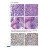 临床病理学疑难案例精析 临床病理住院医师规范化培训实践系列教材 主编应建明 冯晓莉 宋艳 9787117362573人民卫生出版社 商品缩略图4