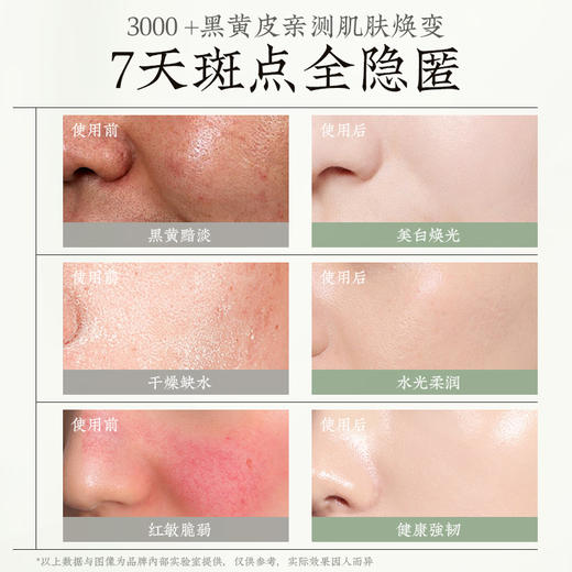 儒意美白保湿精粹水150ml 爽肤水发光水补水保湿去黄提亮收缩毛孔湿敷水|儒意官方商城 商品图2