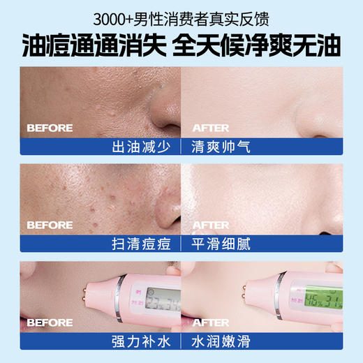 水杨酸男士水乳套装控油祛痘补水保湿收毛孔去黑白头男士护肤|儒意官方商城 商品图4