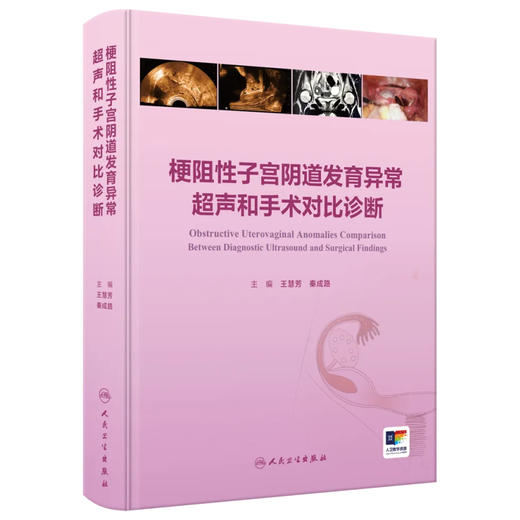 梗阻性子宫阴道发育异常超声和手术对比诊断 子宫阴道的超声检查和正常表现 主编王慧芳 秦成路 9787117369015人民卫生出版社 商品图1