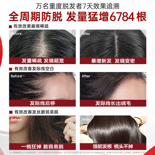 生姜洗发水控油蓬松去屑防脱固发洗头膏露品牌正品官方旗舰店男女|儒意官方商城 商品图2