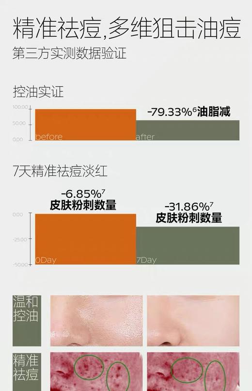 季岚朵小茶瓶祛痘精华液修护泛红舒缓敏感肌抗氧抗糖提亮肤色 商品图3