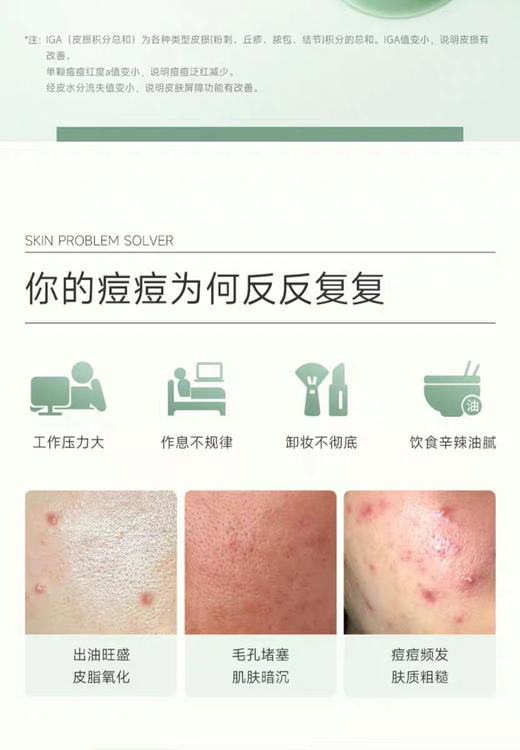 【岁末秒杀】可复美-净痘小绿膜修护屏障控油- 商品图3