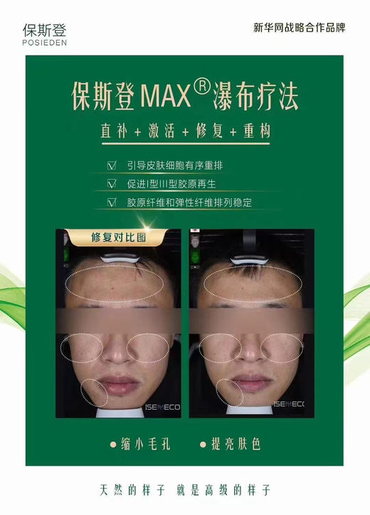 水光皇后3.0保斯登能量素水光5ml单支 配操作包  修复抗yan收缩毛孔提亮肤淡化痘印院线 商品图11