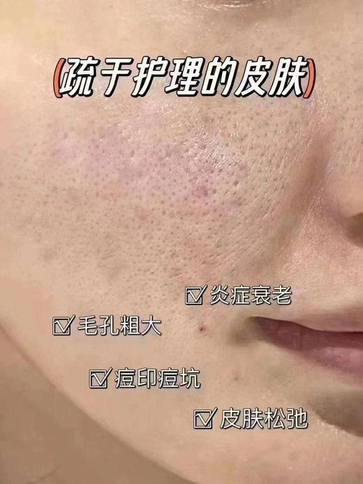 水光皇后3.0保斯登能量素水光5ml单支 配操作包  修复抗yan收缩毛孔提亮肤淡化痘印院线 商品图10