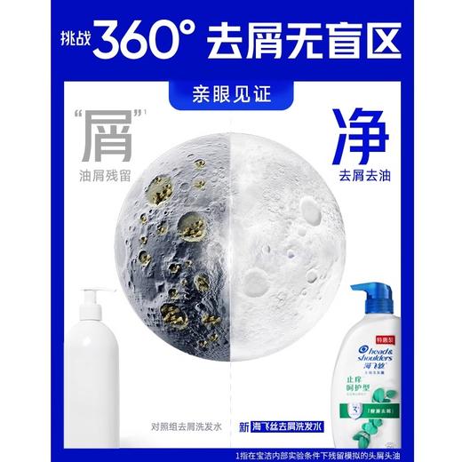 海飞丝止痒呵护型去屑洗发露  750g/瓶 商品图2