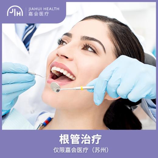 仅限苏州 根管治疗

 商品图0