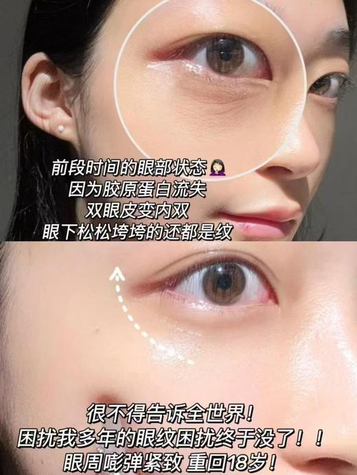 2支欧莱雅复颜视黄醇精粹抗皱眼霜7.5ml*2支=15ml (正装的量) 商品图3