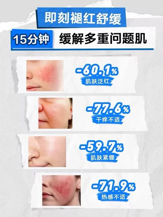 适乐肤神经酰胺屏障修护润肤霜85g 商品图1