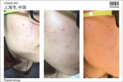 【补水急救维稳面膜组合】十余年口碑海藻胶舒润冰冰膜五片盒装 自家创新专利海藻多糖体成膜 上脸30-60分钟，旅游出行长时间户外必备：海藻胶蓝是来自栀子果提取 商品图4