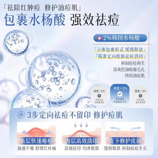 【早晚1支 祛痘不留印】水杨酸祛痘精华1.5ml×30支/盒装#水杨酸祛痘精华液次抛修复淡化痘印疤面部去闭口粉刺黑头收缩毛孔 商品图4