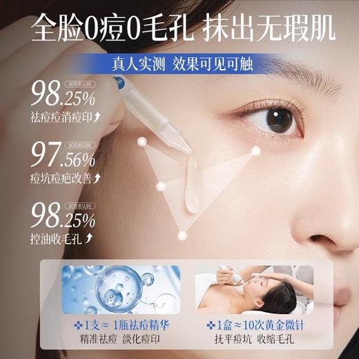 【早晚1支 祛痘不留印】水杨酸祛痘精华1.5ml×30支/盒装#水杨酸祛痘精华液次抛修复淡化痘印疤面部去闭口粉刺黑头收缩毛孔 商品图3