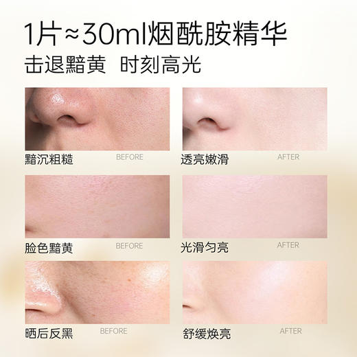 优理氏烟酰胺亮肤安瓶面膜10片装  针对暗沉肌 抗氧提亮  淡痘淡斑  锁水保湿  舒缓面膜-FX 商品图3