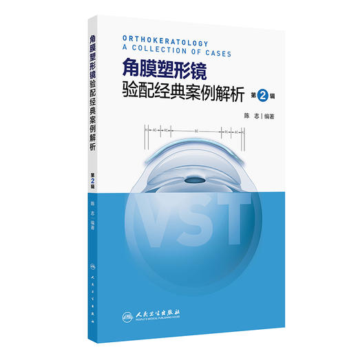 角膜塑形镜验配经典案例解析 第2辑 2024年10月参考书 商品图0