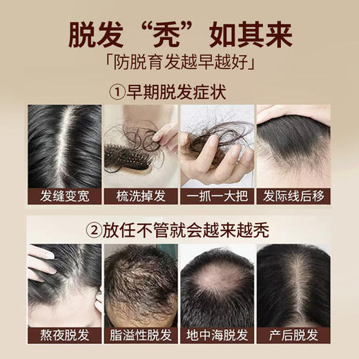 【熬夜党救星，国妆特字防脱洗发露】 正品侧柏叶何首乌当归草本育发防脱洗发水，植物熬制深度滋养稳固发根，止痒控油蓬松洗头水 商品图3