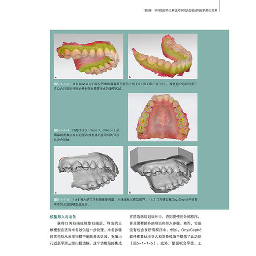 正版全新 无托槽隐形矫治技术 颌面系统矫正 生物力学机制诊断以及治疗设计 谢贤聚 张宁 译 9787559138255辽宁科学技术出版社 商品图4