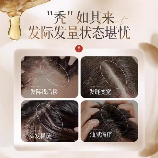 【广药白云山】 拜迪生物防脱洗发水 防脱固发 滋养发根 500ml  国妆特字20232447 商品图2