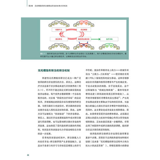 正版全新 无托槽隐形矫治技术 颌面系统矫正 生物力学机制诊断以及治疗设计 谢贤聚 张宁 译 9787559138255辽宁科学技术出版社 商品图3