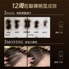密思丝密防脱密发安瓶2盒装防脱育发精华 商品缩略图8