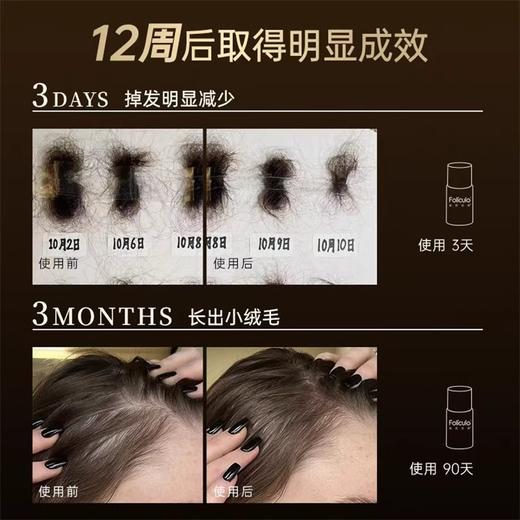 密思丝密防脱密发安瓶2盒装防脱育发精华 商品图8