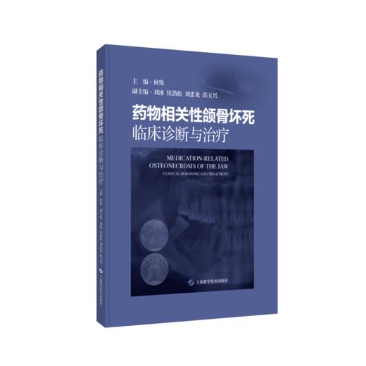 药wu相关性颌骨坏死：临床诊断与治疗 商品图0