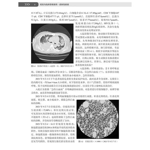 检验与临床思维案例 感染性疾病 第二辑 李敏 许建成 顾兵编 感染性疾病诊疗过程中检验与临床沟通 融合的42个典型案例 科学出版社 商品图4