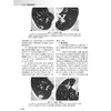 中华影像鉴别诊断学 胸部分册 主编 伍建林 萧毅 解剖生理与疾病特点 影像学在急性咳嗽中的应用 9787117369206人民卫生出版社 商品缩略图4