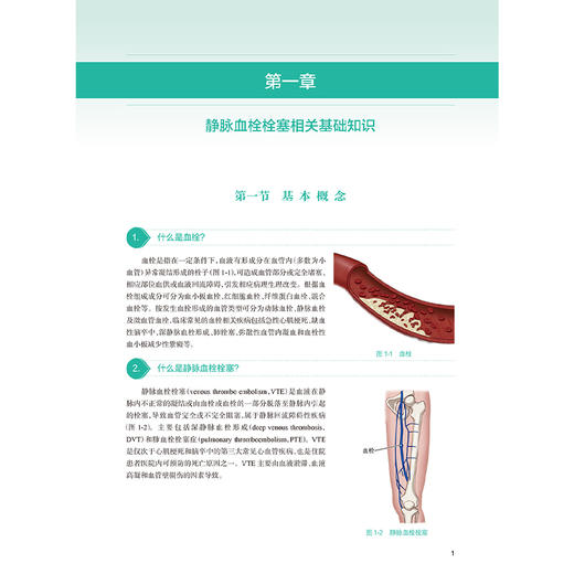 肿瘤患者静脉血栓栓塞防治问答 编易群 贺光明 静脉血栓栓塞相关基础知识 静脉血栓栓塞的病因和发病机制9787117368605人民卫生出版社 商品图3