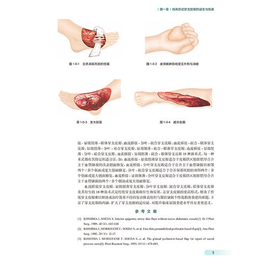 特殊形式穿支皮瓣 唐举玉 主编 临床血管体区术式发展皮瓣唐氏分类法骨科手外科显微外科医学原创性 人民卫生出版社9787117369077 商品图4