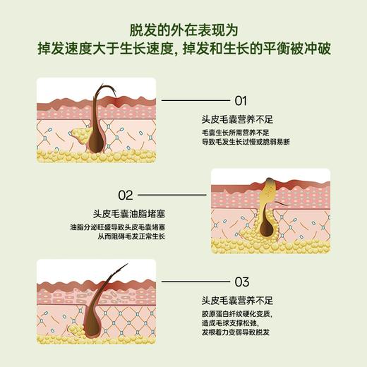 尊荣防脱洗发水 商品图4