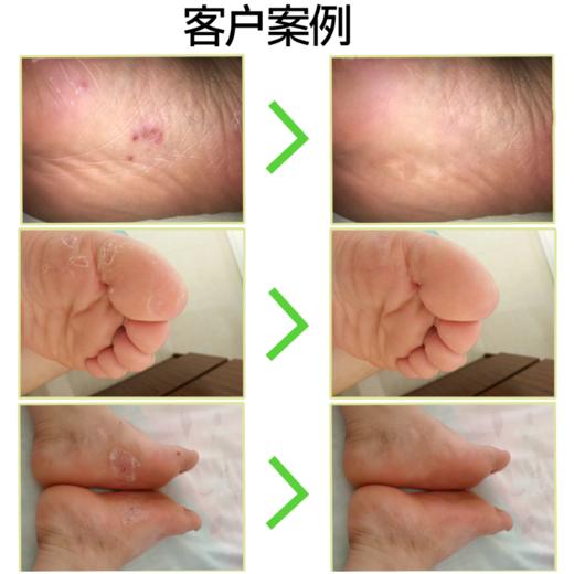 多乐灵自由行抗菌剂清香型、中药型 护理液 商品图4