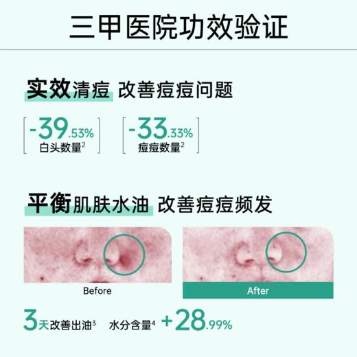 玉泽清痘调护平衡乳50ml 商品图1