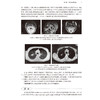 神经内科临床案例解析 供神经领域研究生 住院医师 主治医师及相关医务人员使用 主编徐祖才 余昌胤 9787117368674人民卫生出版社 商品缩略图4
