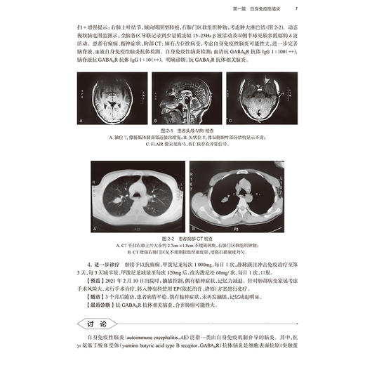神经内科临床案例解析 供神经领域研究生 住院医师 主治医师及相关医务人员使用 主编徐祖才 余昌胤 9787117368674人民卫生出版社 商品图4