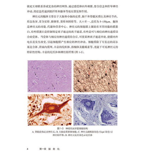 社区认知障碍诊治指南 主编张占军 脑老化的生物学特征 心理因素与脑老化 认知衰弱和心理衰弱的关系 9787117368049人民卫生出版社 商品图4