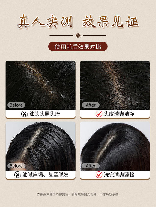 【韵之堂】植萃草本头皮净化液  300ml/瓶 商品图1