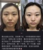 海南税仓保Z～SK小灯泡美白淡斑精华乳 商品缩略图7