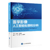 医学影像人工智能处理和分析   卢洁 黄靖 孙洪赞 主编   北医社 商品缩略图0