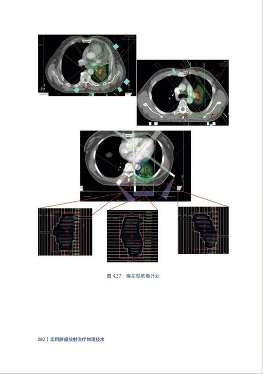 实用肿瘤放射治疗物理技术 商品图7