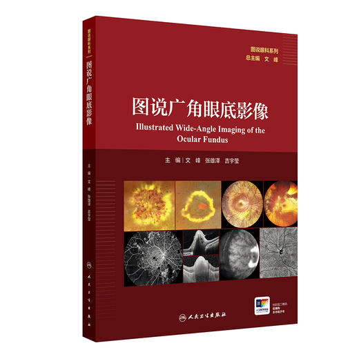 图说广角眼底影像 主编文峰 张雄泽 吉宇莹 遗传性视网膜脉络膜病变 眼底炎症与感染 视网膜血管性疾病9787117370912人民卫生出版社 商品图1