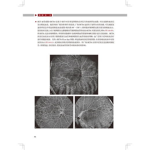 图说广角眼底影像 主编文峰 张雄泽 吉宇莹 遗传性视网膜脉络膜病变 眼底炎症与感染 视网膜血管性疾病9787117370912人民卫生出版社 商品图4