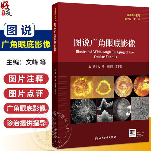 图说广角眼底影像 主编文峰 张雄泽 吉宇莹 遗传性视网膜脉络膜病变 眼底炎症与感染 视网膜血管性疾病9787117370912人民卫生出版社 商品图0