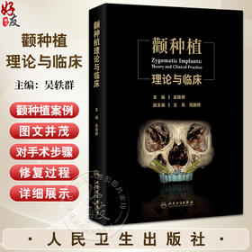 颧种植理论与临床 主编吴轶群 颧种植 倾斜种植与微创化手术 颧种植技术需求的社会基础 9787117368544人民卫生出版社