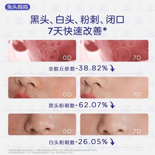 兔头妈妈青少年酵母精粹润肤乳120g 商品图2