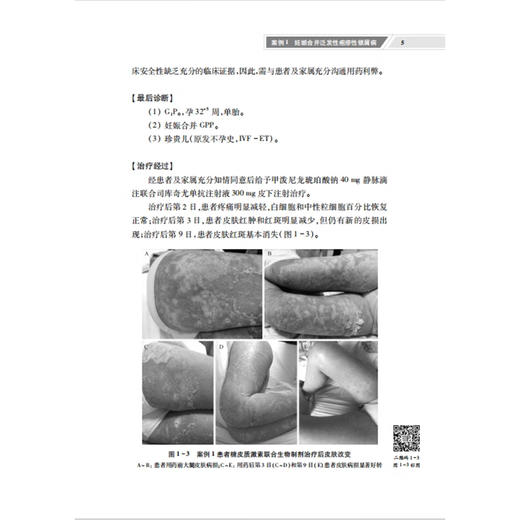 产科MDT诊疗实践 刘铭 施君瑶 主编 适合从事妇产科临床工作的各级医生阅读 妊娠合并喉阻塞 9787030795151科学出版社  商品图4