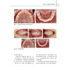 替牙列期矫治实践 基于无托槽隐形矫治系统的诊疗策略与流程 颅颌牙列生长发育变化概述 著刘思琦9787559137982辽宁科学技术出版社 商品缩略图4